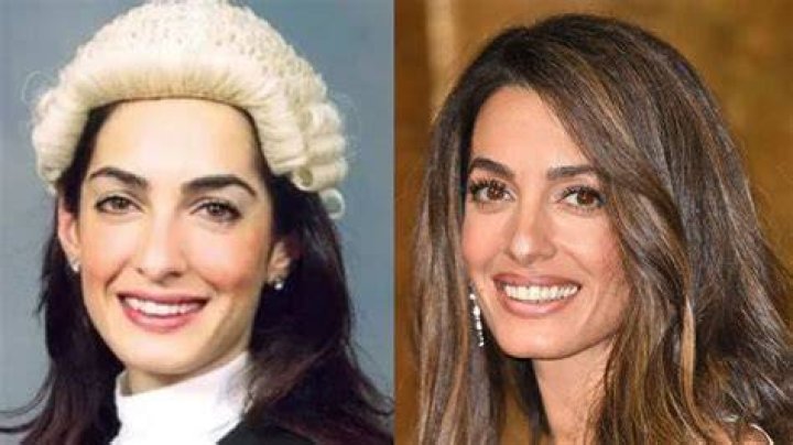 Amal Clooney Plastic Surgery 2023 Before And After Photos