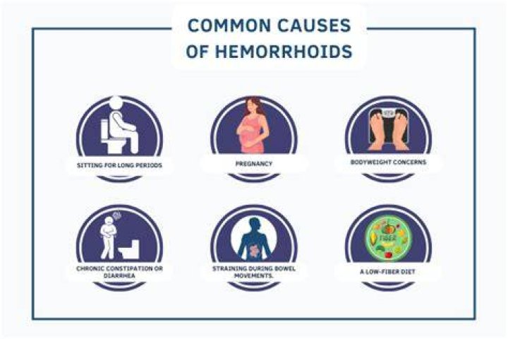 Can heat cause hemorrhoids?