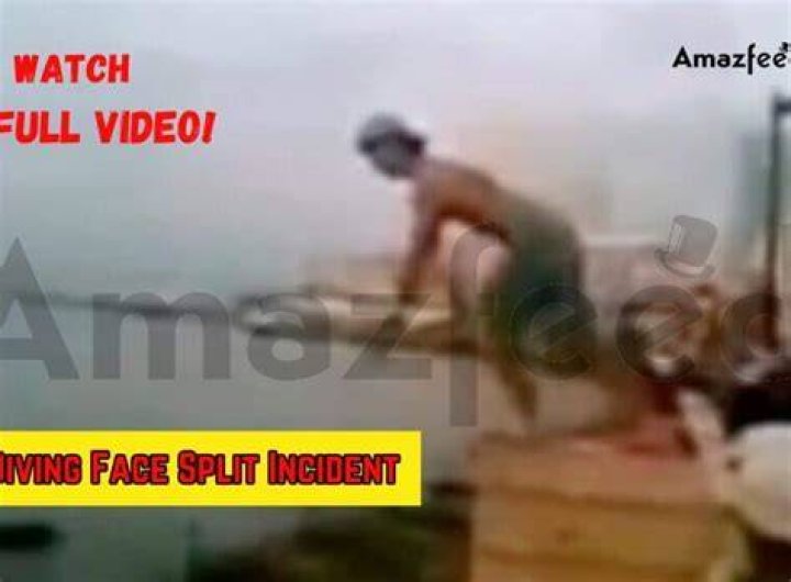 Face Split Incident spain diving accident resurfaced on social media