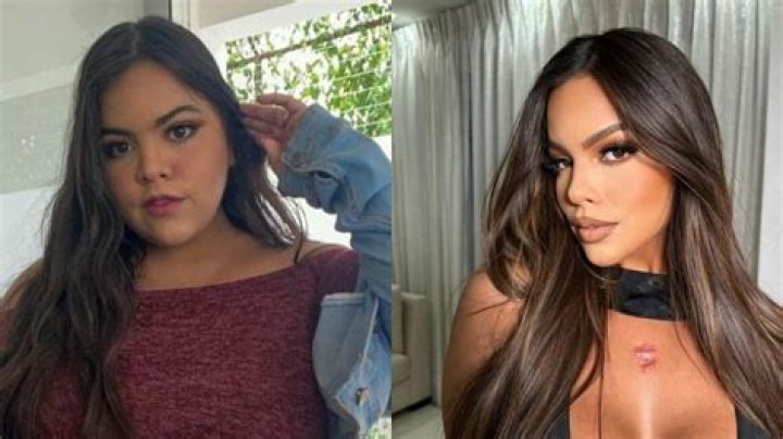 Gracie Bon Plastic Surgery Her Transformation Revealed SparkVlog