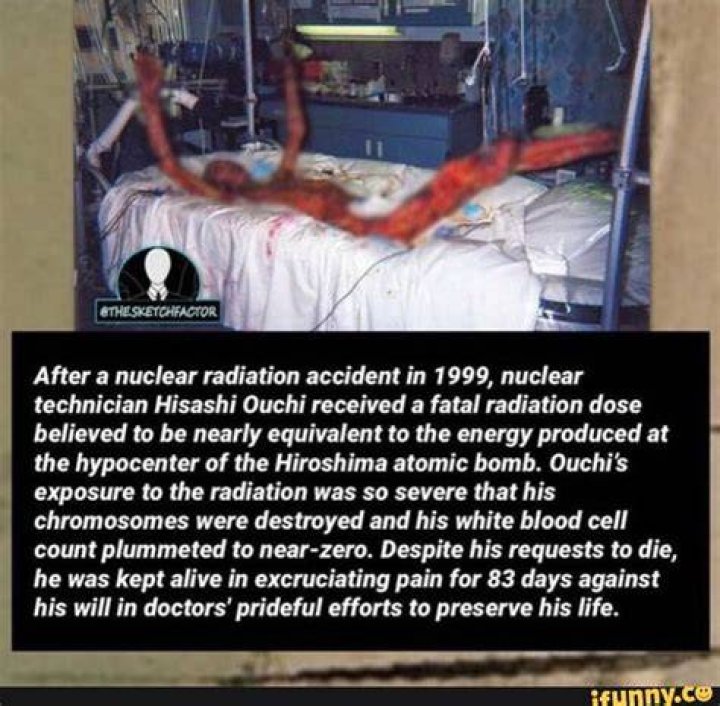 Hisashi Ouchi Autopsy Report A Detailed Examination Of The Tragic Incident
