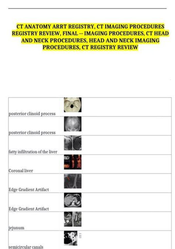 How difficult is the CT registry?