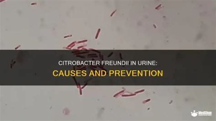 How do you get Citrobacter?