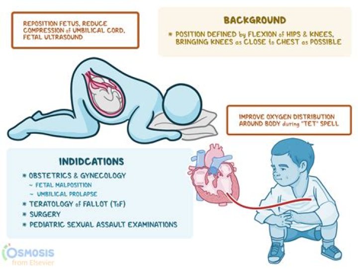 How does knee-chest position work?