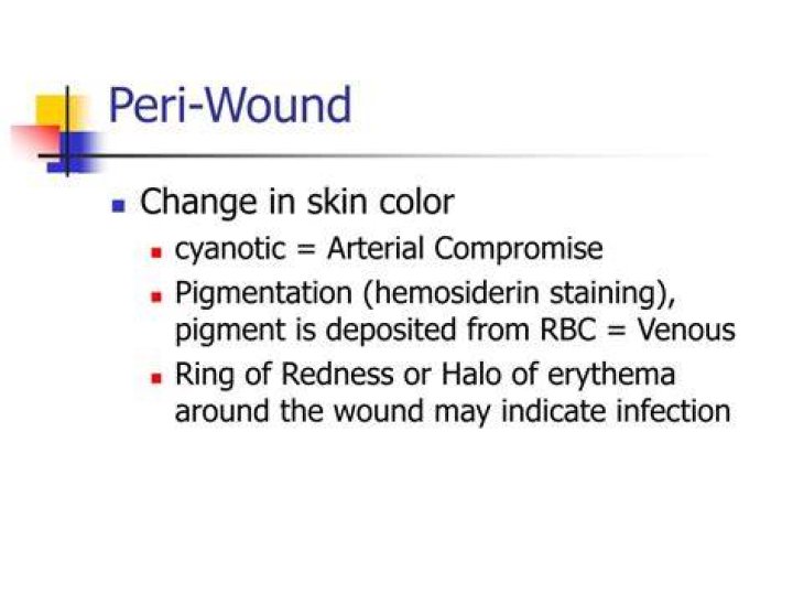 How To Describe Peri-wound? (Solution)