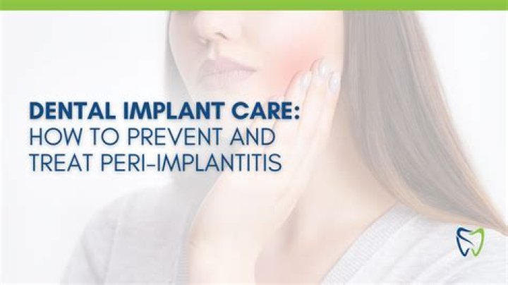 How To Treat Peri Implantitis? (Solution)
