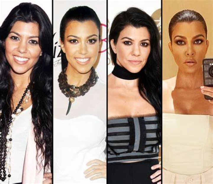 kardashians before after