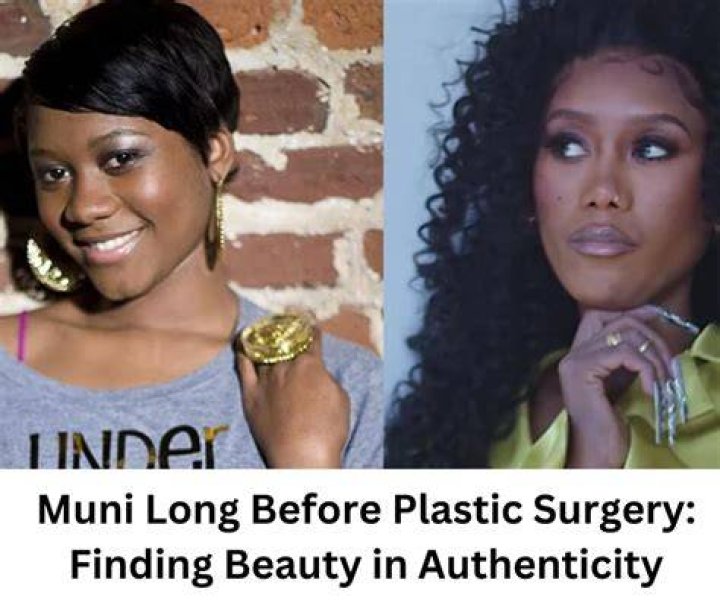 Muni Long Before Plastic Surgery: A Journey Through Her Transformation