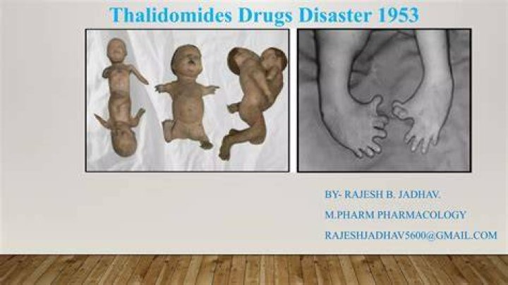 The Tragic History of Thalidomide and Phocomelia