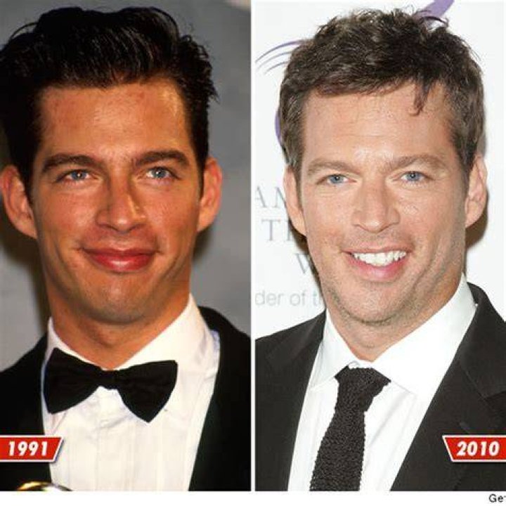 Understanding Harry Connick Jr.'s Stroke: A Comprehensive Guide