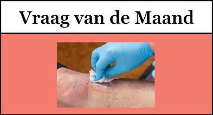 Welke Honing Op Wonden? (Solution)