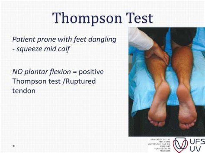 What does a positive Thompson test mean?
