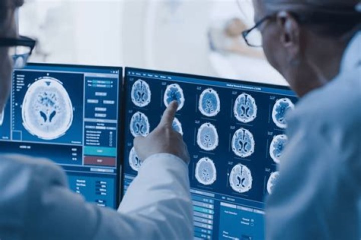 What Does Peri Stand For In Medical Terms? (Correct answer)