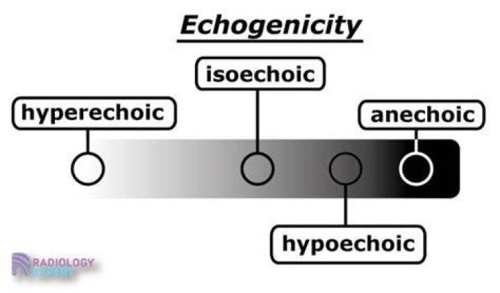 What is increased echogenicity mean?