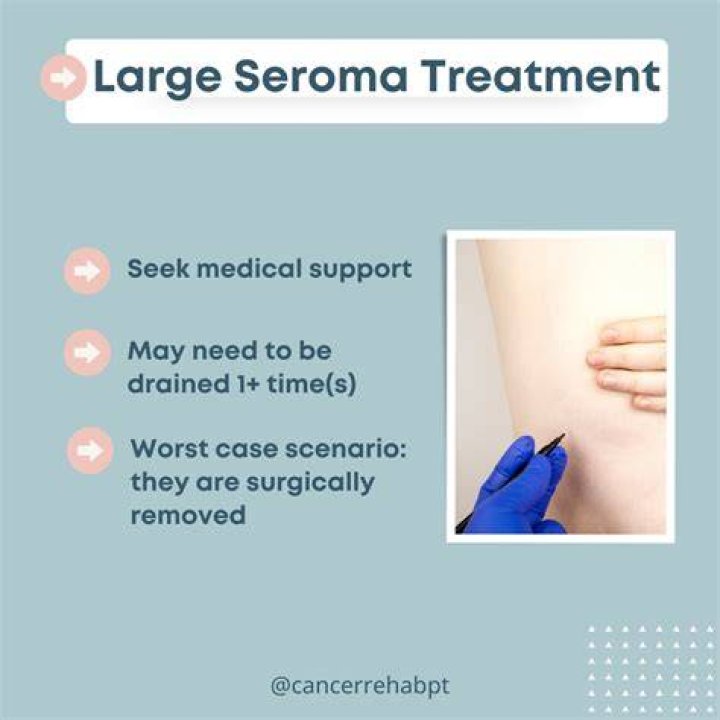 What Is Peri-implant Seroma? (Solution found)
