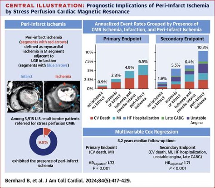 What Is Peri-infarct Ischemia? (Solved)