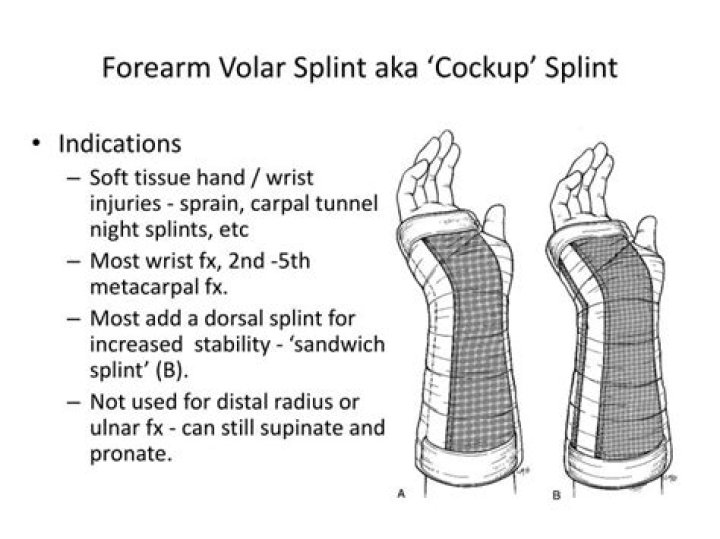 What is the CPT code for Velcro wrist splint?