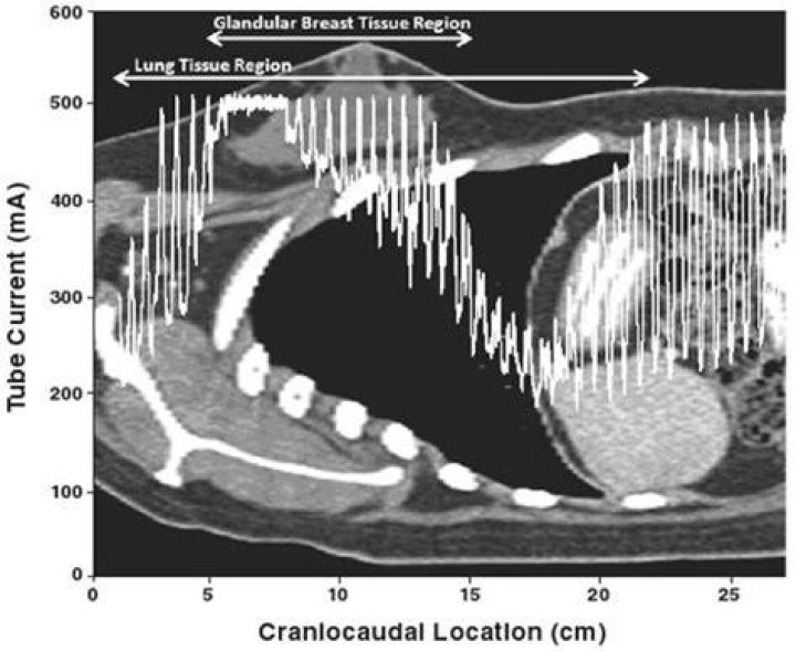 What is tube current in CT?