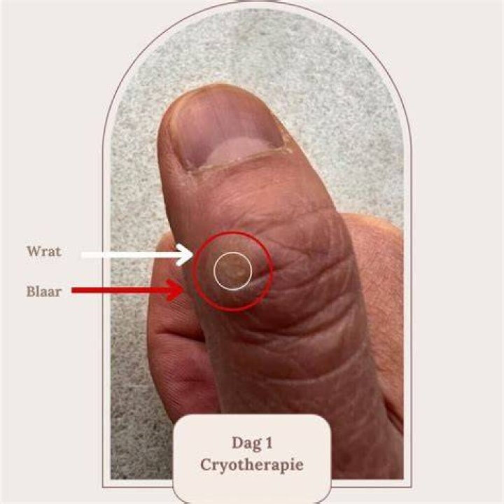 What is WRAT used for?