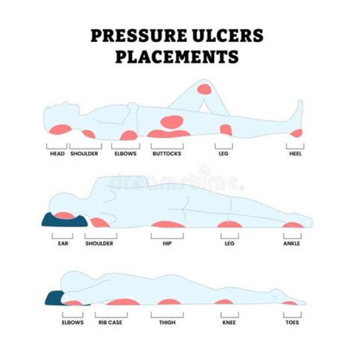 What To Use For Sore Peri Area? (Solved)
