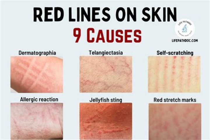 When should I be worried about red streaks?
