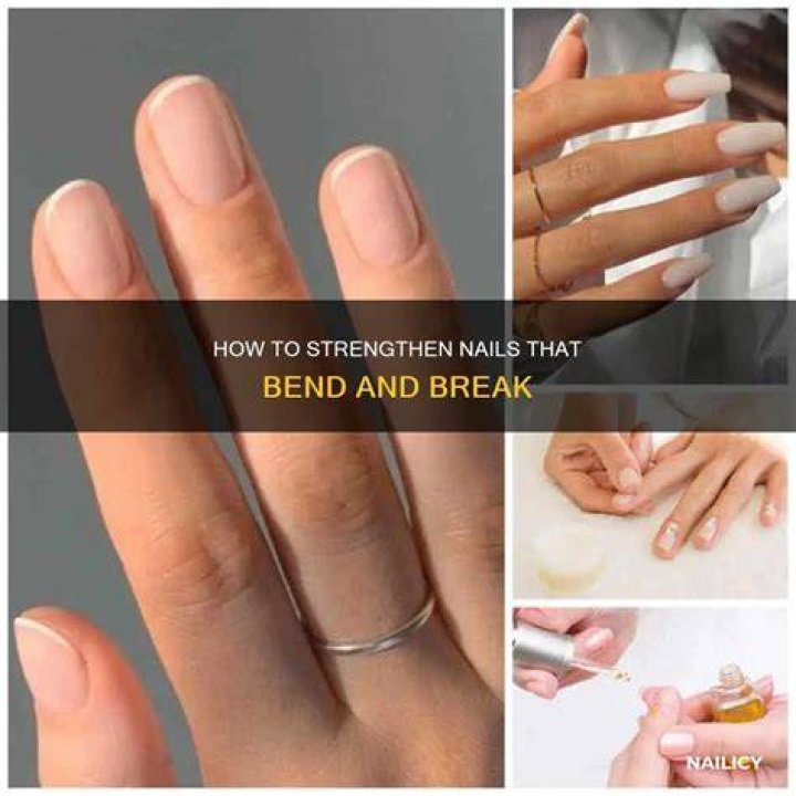 Why do my nails bend upwards?