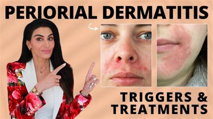 Why Does Makeup Cause Peri Dermatitus? (TOP 5 Tips)