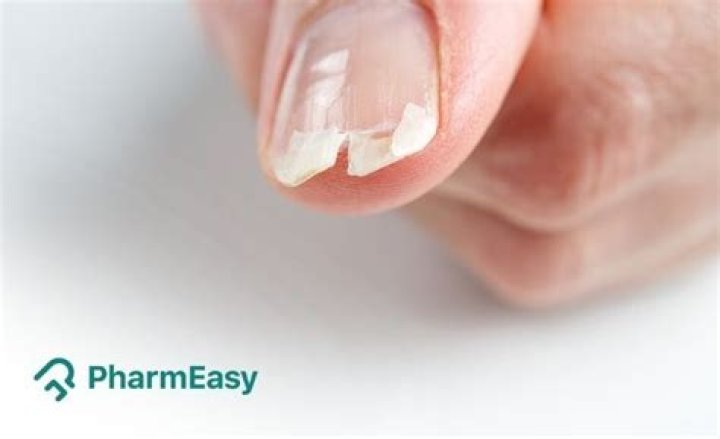 Why does my nail always split down the middle?