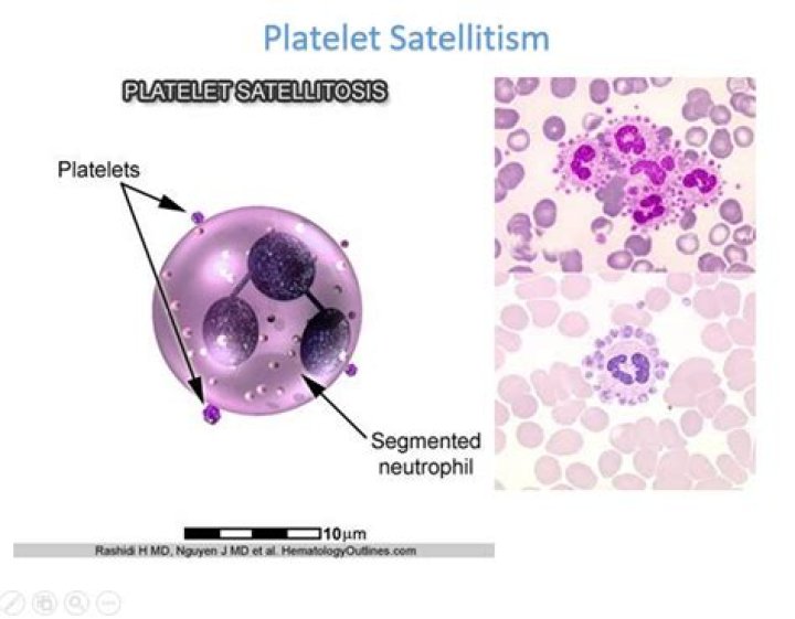 Why does platelet Satellitism occur?
