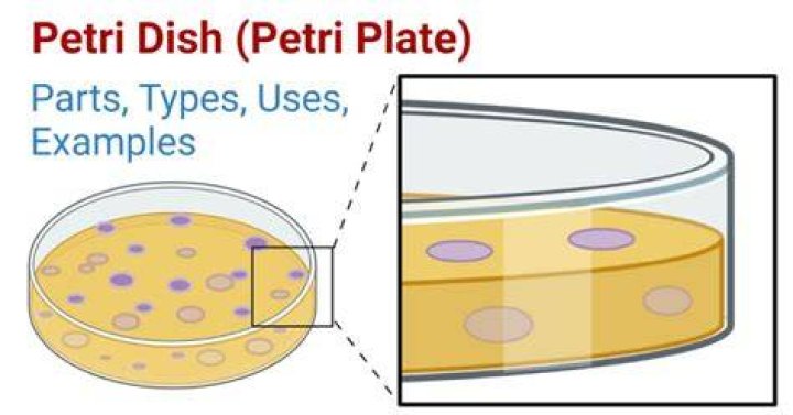 Why Should A Peri Dish Not Left Open For Any Extended Period? (Correct answer)